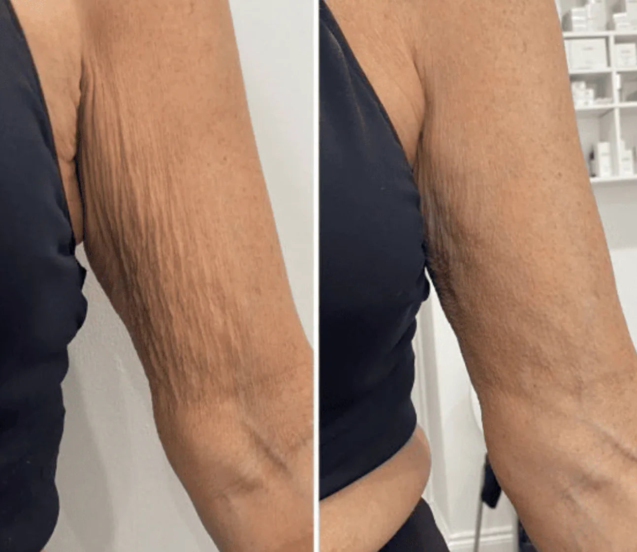 BodySculpture Alta Cosmética – Tratamiento Corporal Anticelulitis, Reafirmante y Tonificante – 230 ml