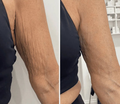 BodySculpture Alta Cosmética – Tratamiento Corporal Anticelulitis, Reafirmante y Tonificante – 230 ml